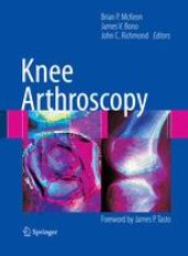 book Knee Arthroscopy