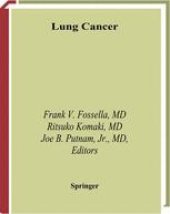 book Lung Cancer