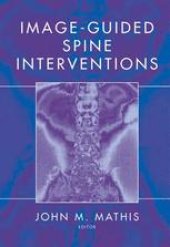 book Image-Guided Spine Interventions