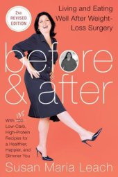 book Before & After, Second: Living and Eating Well After Weight-Loss Surgery