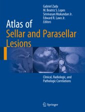 book Atlas of Sellar and Parasellar Lesions Clinical, Radiologic, and Pathologic Correlations