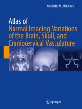 book Atlas of Normal Imaging Variations of the Brain, Skull, and Craniocervical Vasculature