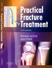 book Practical Fracture Treatment