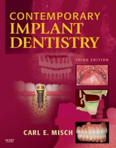 book Contemporary implant dentistry