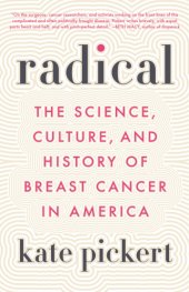 book Radical: the science, culture, and history of breast cancer in America