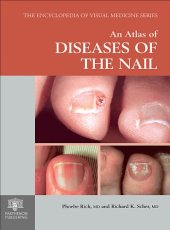 book An atlas of diseases of the nail