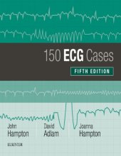 book 150 ECG Cases [CONVERTED PDF]