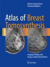 book Atlas of Breast Tomosynthesis Imaging Findings and Image-Guided Interventions