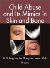 book Child Abuse and its Mimics in Skin and Bone