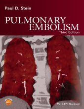 book Pulmonary Embolism