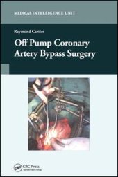 book Off-Pump Coronary Artery Bypass Surgery