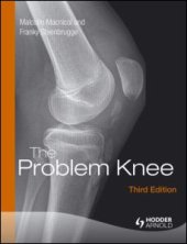 book The Problem Knee