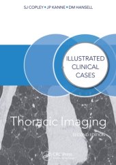 book Thoracic Imaging: Illustrated Clinical Cases, Second Edition