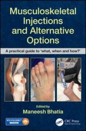 book Musculoskeletal Injections and Alternative Options: A practical guide to 'what, when and how?'