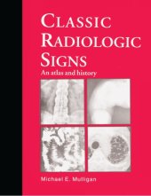 book Classic radiologic signs an atlas and history