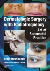 book Dermatologic surgery with radiofrequency: art of successful practice