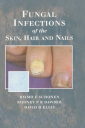 book Fungal Infections Of The Skin And Nails