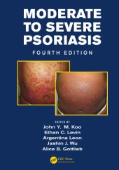 book Moderate to Severe Psoriasis, Fourth Edition