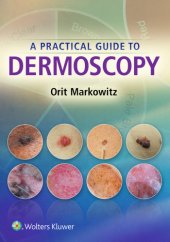 book A Practical Guide to Dermoscopy, 1e