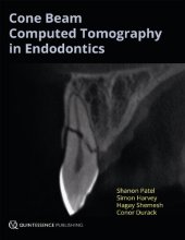 book Cone Beam Computed Tomography in Endodontics