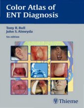 book Color Atlas of ENT Diagnosis