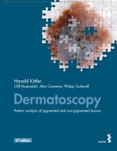 book Dermatoscopy - Pattern analysis of pigmented and non-pigmented lesions