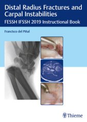 book Distal Radius Fractures and Carpal Instabilities: FESSH IFSSH 2019 Instructional Book