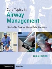 book Core Topics in Airway Management