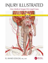 book Injury Illustrated: How Medical Images Win Legal Cases