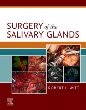 book Surgery of the Salivary Glands