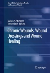 book Chronic Wounds, Wound Dressings and Wound Healing