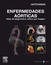 book Enfermedades aórticas