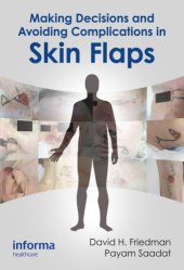 book Making decisions and avoiding complications in skin flaps