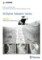 book Aospine Masters Series, Volume 4: Adult Spinal Deformities