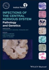 book Infections of the Central Nervous System: Pathology and Genetics