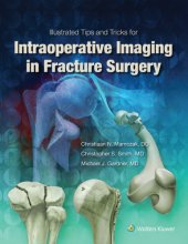 book Illustrated Tips and Tricks for Intraoperative Imaging in Fracture Surgery