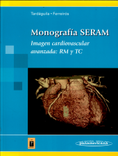 book Imagen Cardiovascular Avanzada: Rm Y Tc