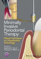 book Minimally Invasive Periodontal Therapy: Clinical Techniques and Visualization Technology