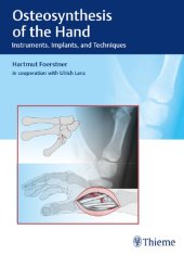 book Osteosynthesis of the Hand: Instruments, Implants, and Techniques