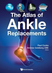 book The Atlas of Ankle Replacements