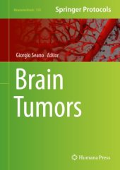 book Brain Tumors