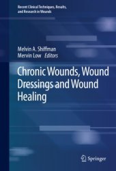 book Chronic Wounds, Wound Dressings and Wound Healing