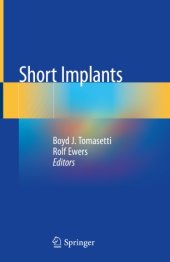 book Short Implants