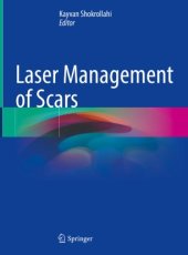 book Laser Management of Scars