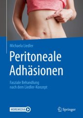 book Peritoneale Adhäsionen: Fasziale Behandlung nach dem Liedler-Konzept