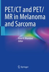 book PET/CT and PET/MR in Melanoma and Sarcoma