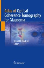 book Atlas of Optical Coherence Tomography for Glaucoma