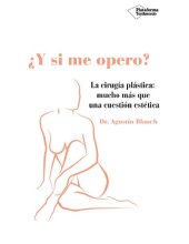 book ¿Y si me opero? (Spanish Edition)