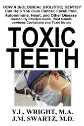 book Toxic Teeth: How a Biological (Holistic) Dentist Can Help You Cure Cancer, Facial Pain, Autoimmune, Heart, and Other Disease Caused By Infected Gums, Root ... Jawbone Cavitations, and Toxic Metals