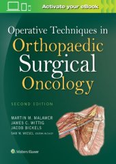 book Operative Techniques in Orthopaedic Surgical Oncology